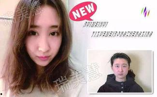 爆料整形诱导案例最新,最新案例警示录